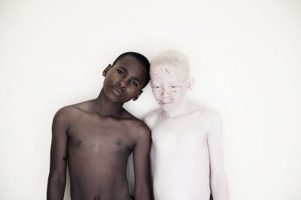 Toplum Tarafından Dışlanan Albino Çocuklardan Sıradışı Bir Proje - 3
