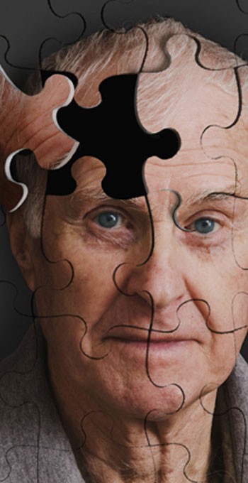 Alzheimerden Korunmanın 10 Yolu!